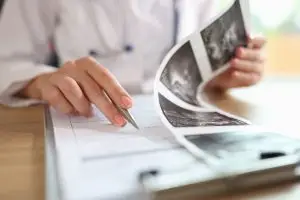 quistes ovarios menopausia